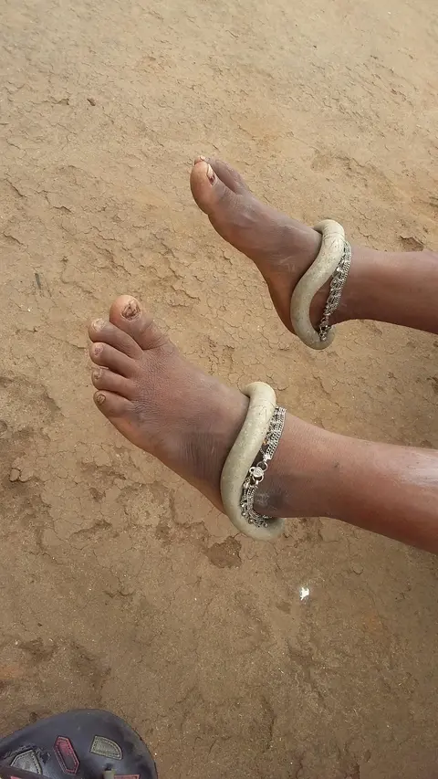 सूळाङ  Madia anklets